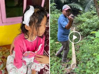 Salah satu anak yang menjadi korban penyerangan monyet liar di Kelurahan Bontokamase Kecamatan Herlang, Bulukumba.